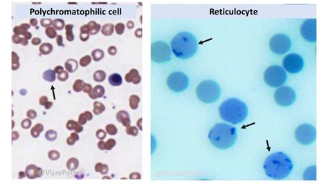 Boosting Website Performance: The Power of Reticular Site Count