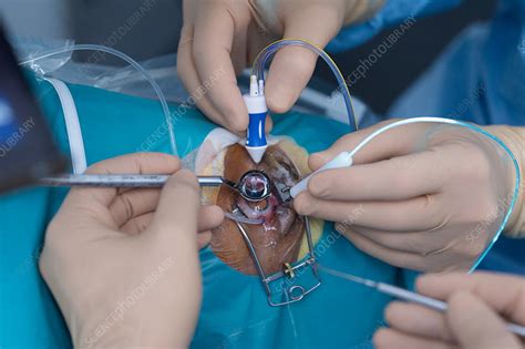 Revive Your Vision: What You Need to Know About Retina Operation Surgery