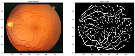 retinal blood vessel segmentation github