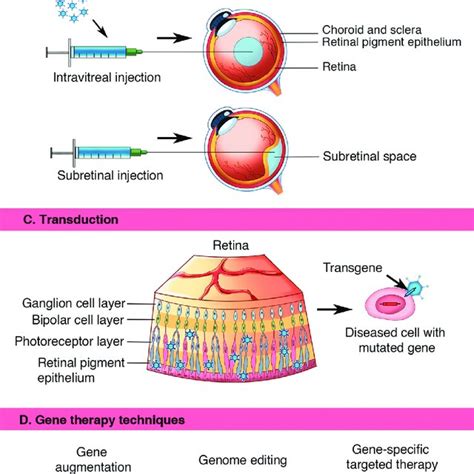 Retinal Gene Therapy Under a Microscope