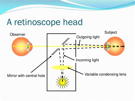 Retinoscopy Definition