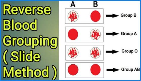 reverse blood grouping slide method