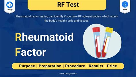 Unlocking Accurate Diagnostics: What You Need to Know About RF Lab Testing