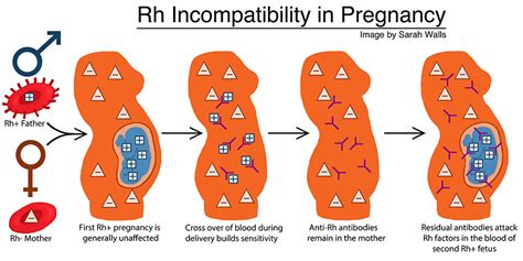 Rh Meaning Temperature