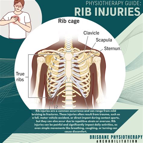 Rib Pain Zaps