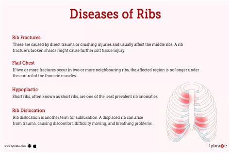 Ribs Conditions