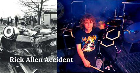 rick allen attacked by accident