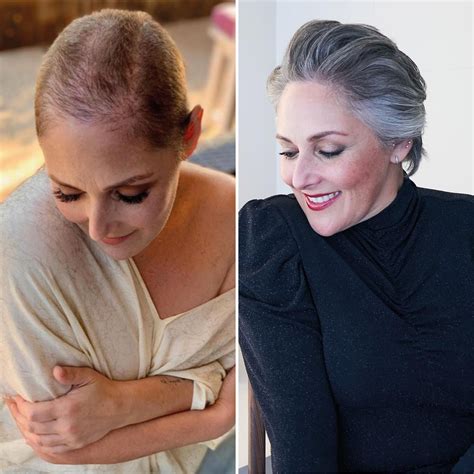 ricki lake hair loss product