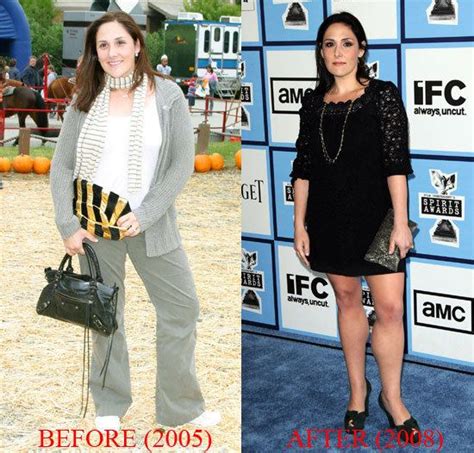 ricki lake weight loss surgery