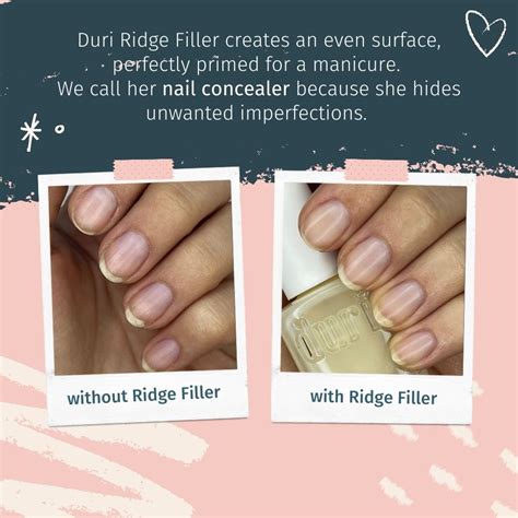 Ridge Filler Nails