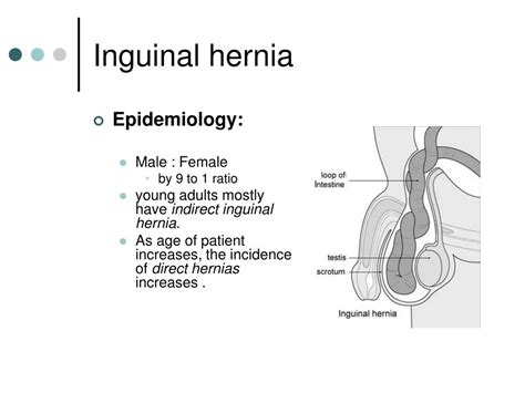 right inguinal hernia