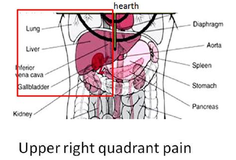 Understanding Right Upper Quadrant Discomfort: Causes, Symptoms, and Relief Options