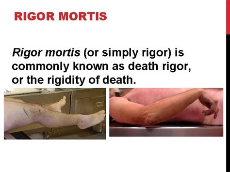 rigor mortis meaning