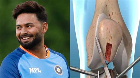 rishabh pant's recovery status and timeline