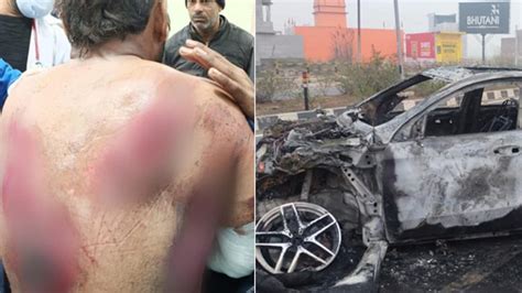 rishabh pant car accident news hindi