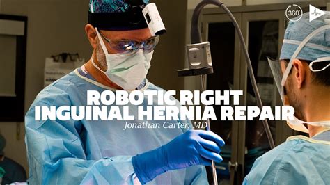 robotic surgery for hernia