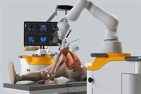 Robotic Tkr Video