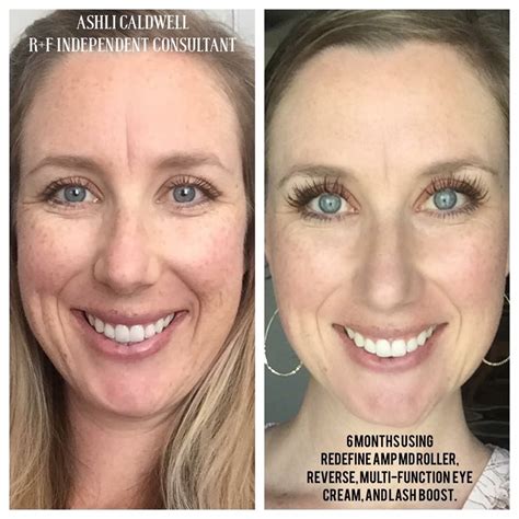 rodan and fields redefine with lash boost