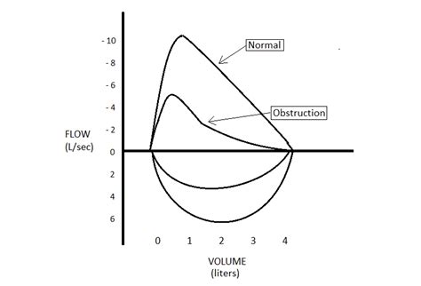 Role Of Spirometry In Copd