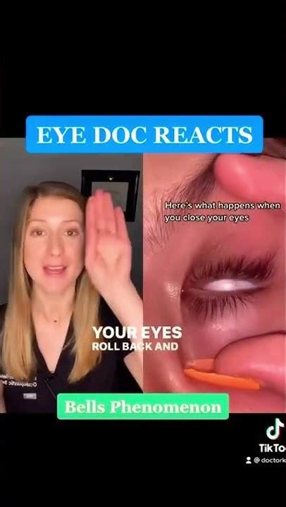 Rolling Eye Doctor