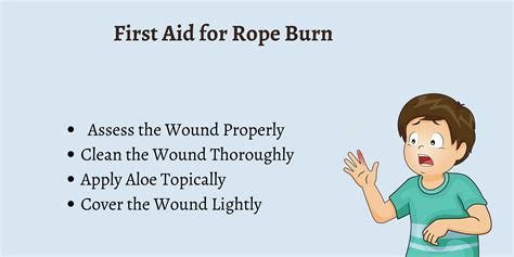 Rope Burn Def