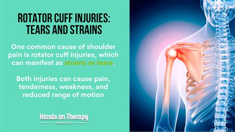 Rotator Cuff Sprain Vs Strain