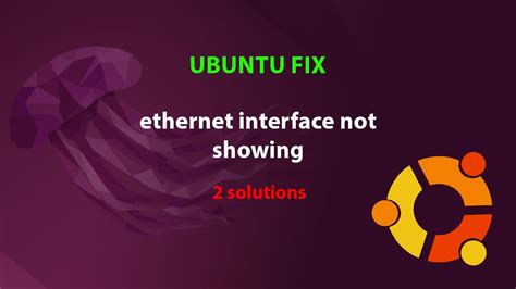Router Interface Not Showing