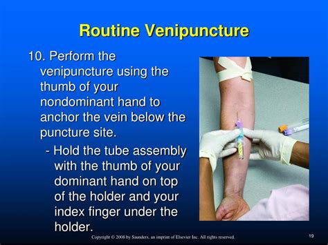 Routine Venipuncture Procedure