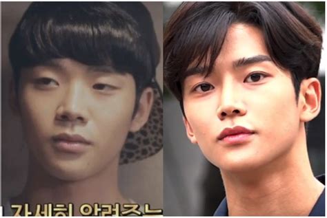 rowoon before and after