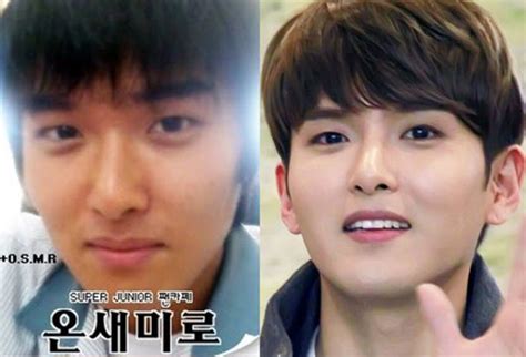 ryeowook surgery