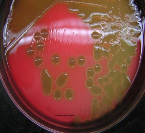 s. pneumoniae on blood agar