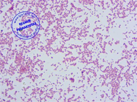 s.marcescens under microscope