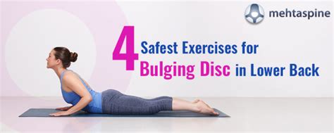 safe exercises for bulging disc in lower back