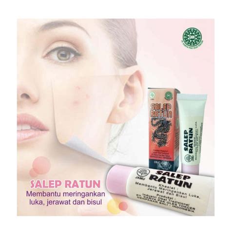 √ 10 Salep Jerawat Bisul Ampuh, Cepat Kering dan Tidak Meninggalkan Bekas