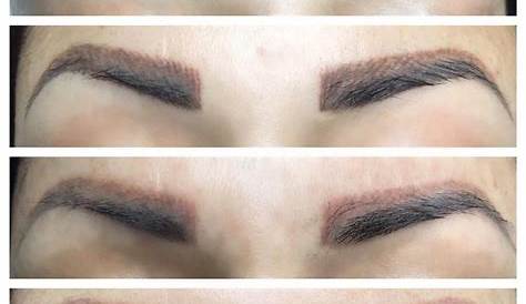 Saline Eyebrow Tattoo Removal Aftercare Liked It A Lot Record Image Bank