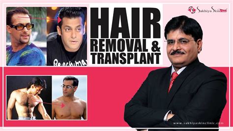 salman khan hair transplant doctor