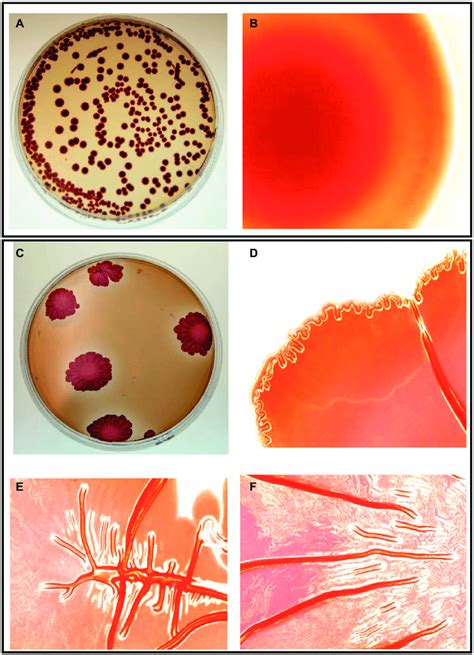 salmonella typhimurium atcc