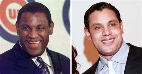 sammy sosa skin before and after