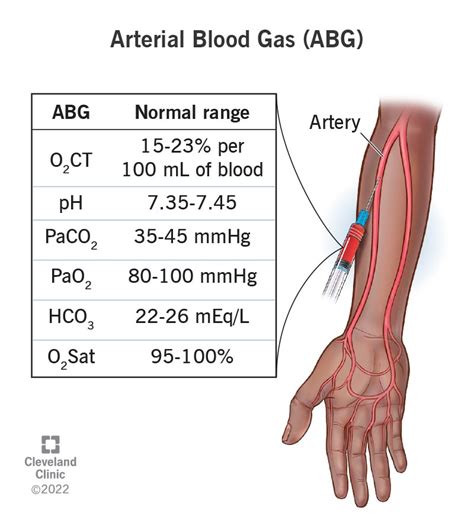 Sample Blood Gas