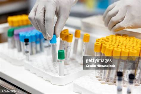 Sample Handling In Laboratory