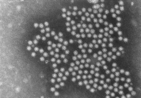 sapovirus