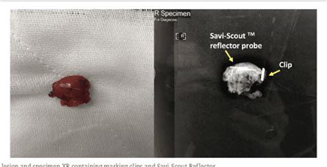 savi scout side effects