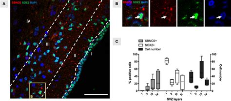 sbno2