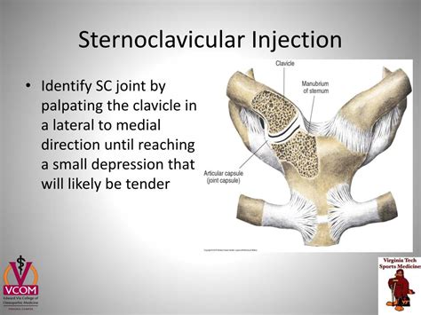 sc joint injection cpt code