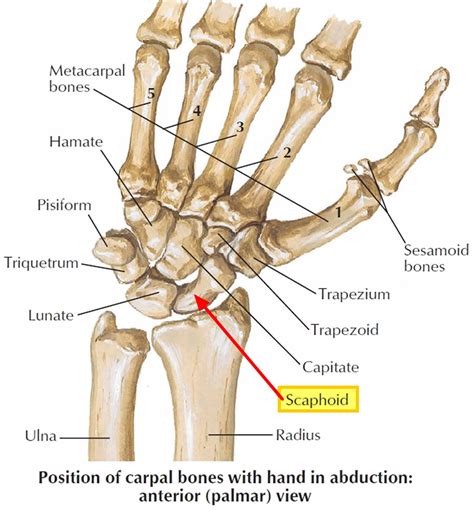 Understanding Scaphoid Bone Fracture: Causes, Symptoms, and Treatment Options