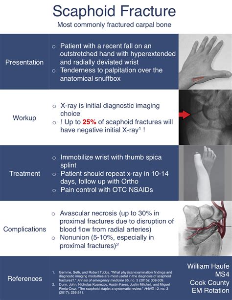 Scaphoid Fracture Symptoms