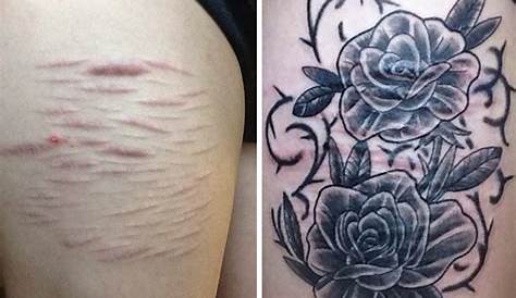 Insanely creative cover up Burn Tattoo, Tattoo Over Scar, Cover-up