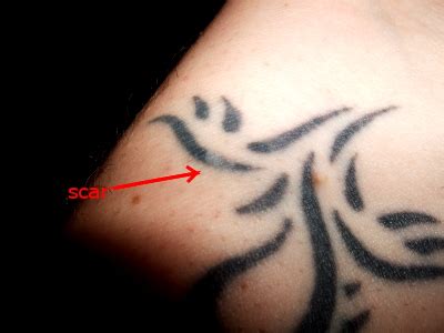 Scarring Tattoo