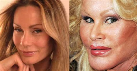 scary plastic surgery faces
