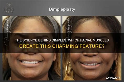 Science Behind Indian Dimples
